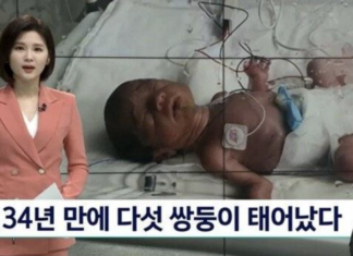 한국에서 34년만에 태어난 다섯 쌍둥이 남매